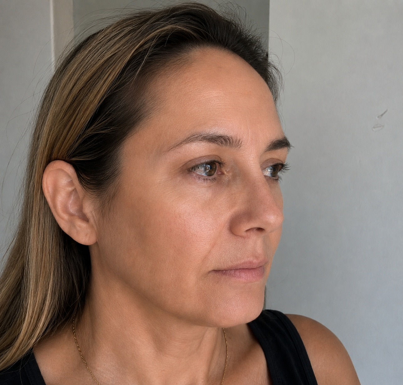 Con Botox